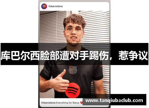 库巴尔西脸部遭对手踢伤，惹争议